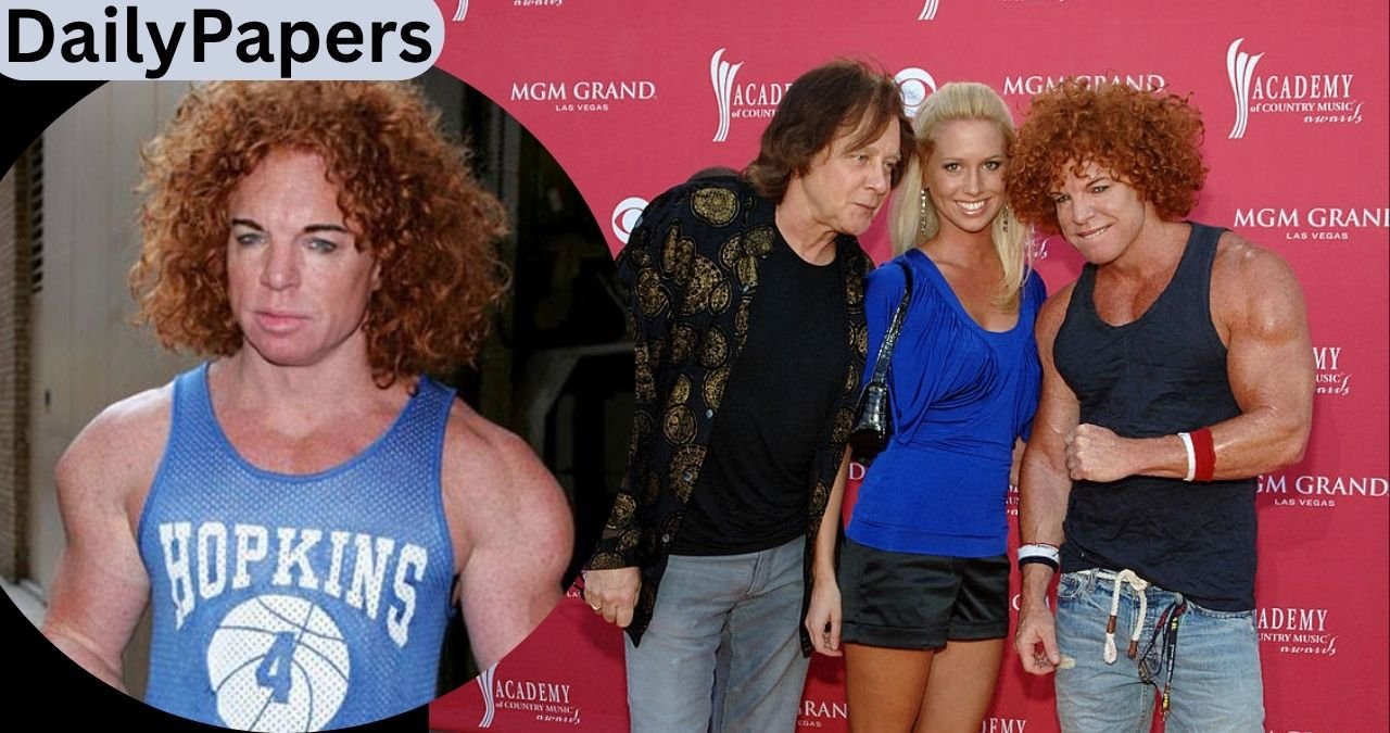 carrot top